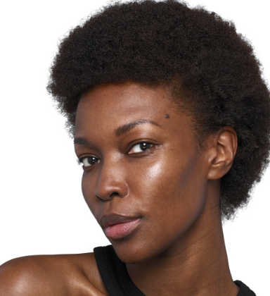 Before SkinVive treatment
