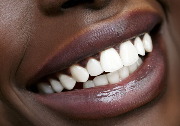 Lip filler treatment